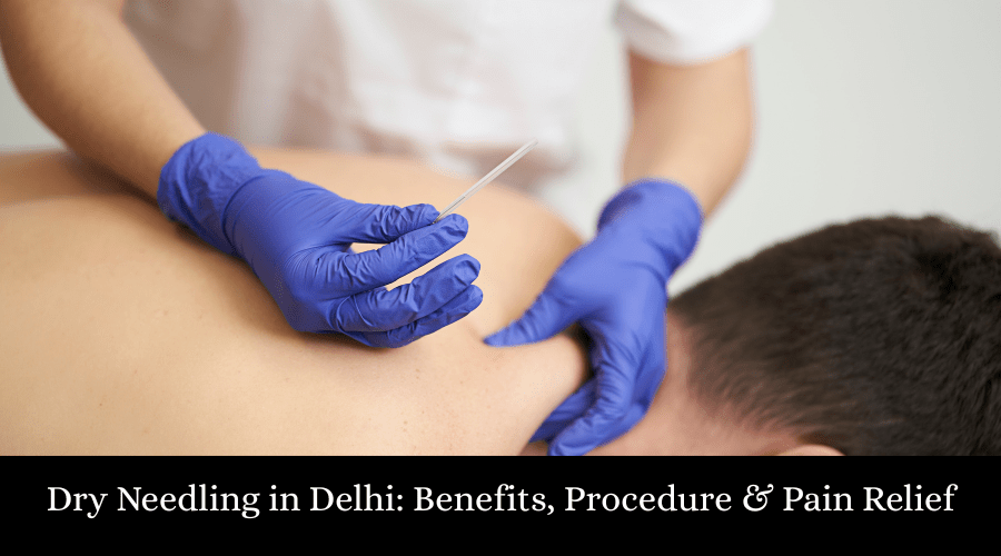 Dry Needling in Delhi Benefits, Procedure & Pain Relief